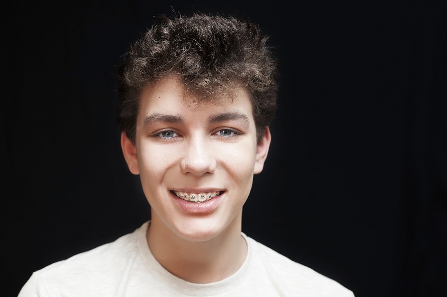 List of Foods To Avoid With Braces