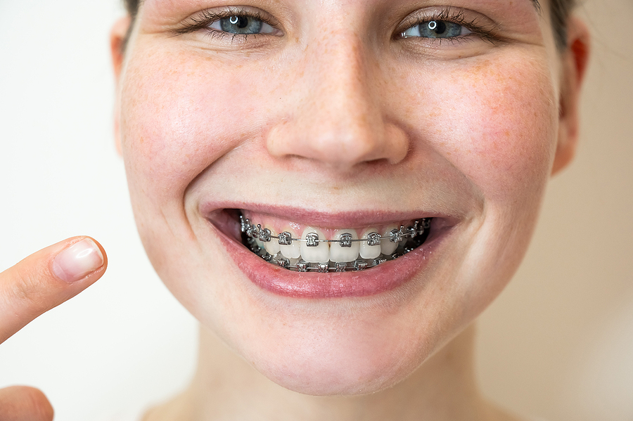 Braces and Musical Instruments – Can You Play a Musical Instrument With Braces?