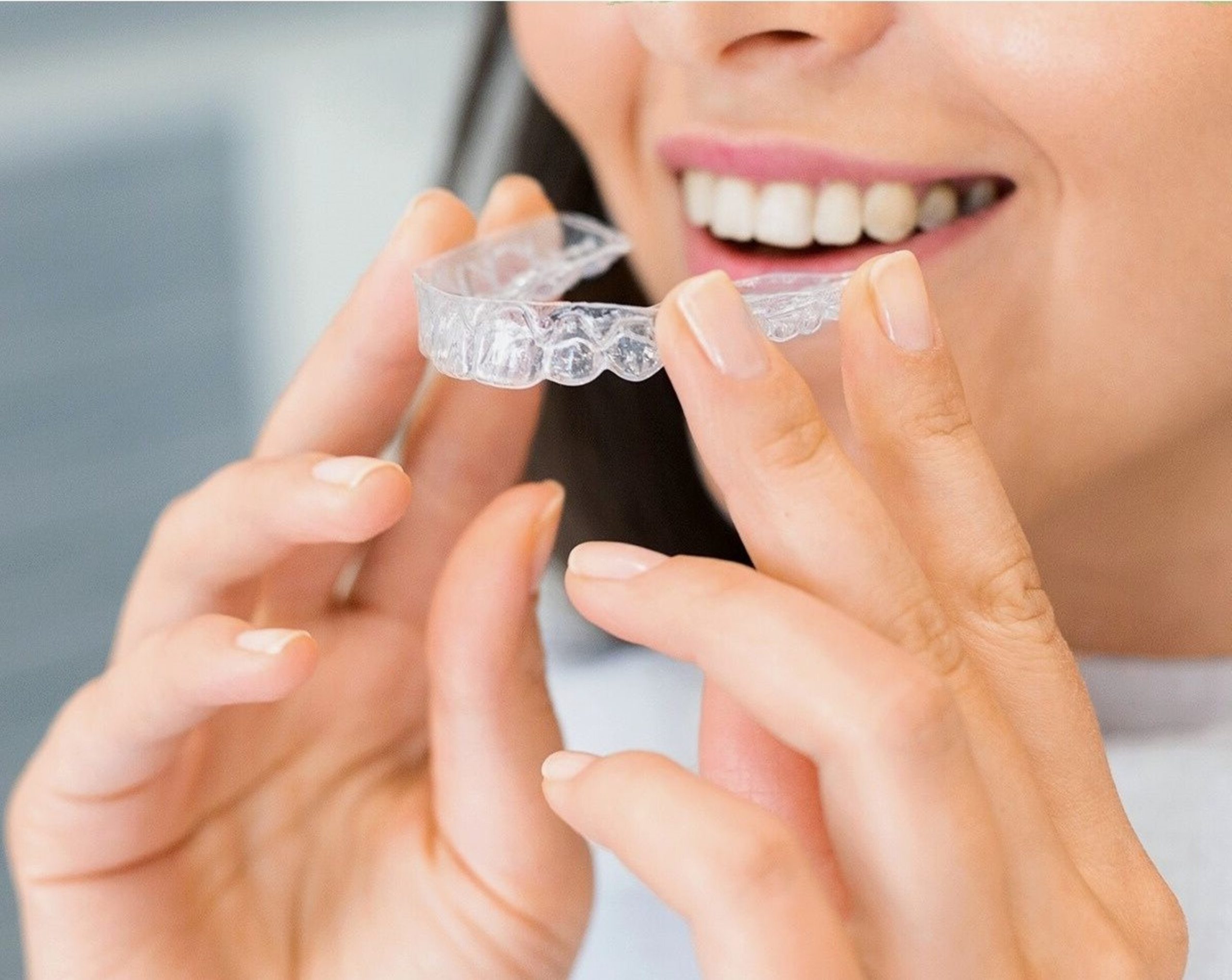 Everything to Know About Spark Aligners